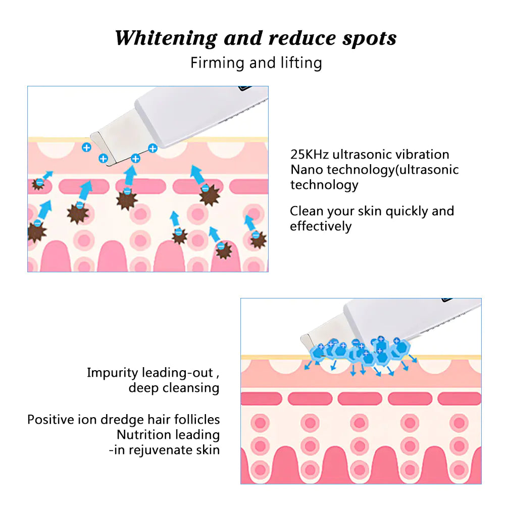 Ultrasonic Facial Cleanser & Pore Vacuum – Deep Cleaning + Skin Rejuvenation in One